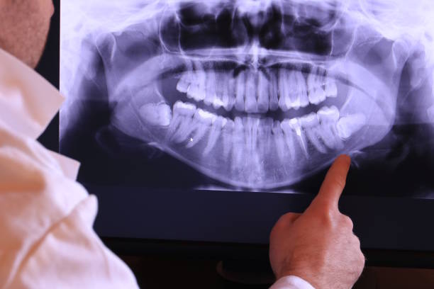 Best Emergency Treatment for Dental Infections or Abscesses in Lake Mathews, CA