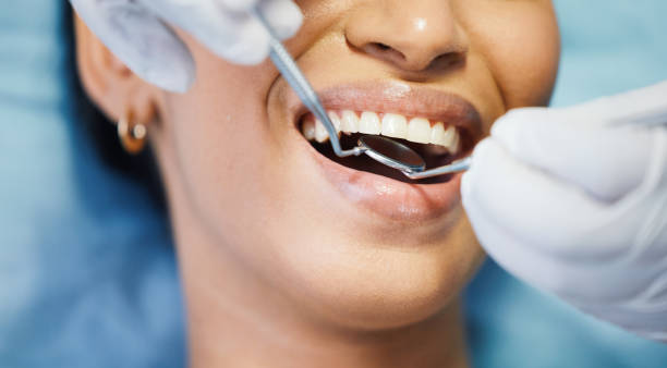 Best Emergency Dental Care for Broken or Chipped Teeth in Lake Mathews, CA
