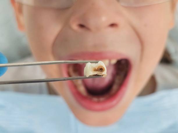 Best Pediatric Emergency Dentist in Lake Mathews, CA